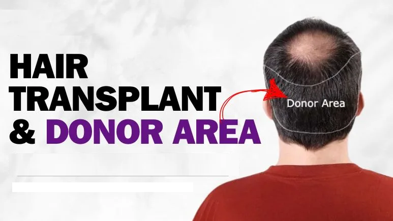 Are You a Right Candidate for Hair Transplant?