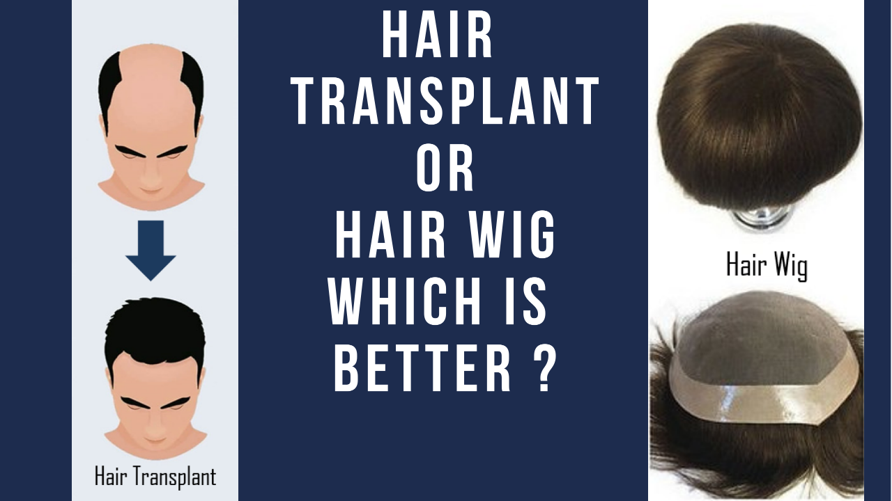 Hair Transplant vs Hair Patch – What’s Right for You?